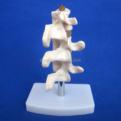 Προχωρημένα εκπαιδευτικά μοντέλα PVC Cutaway Οστεοπόρωση της σπονδυλικής στήλης