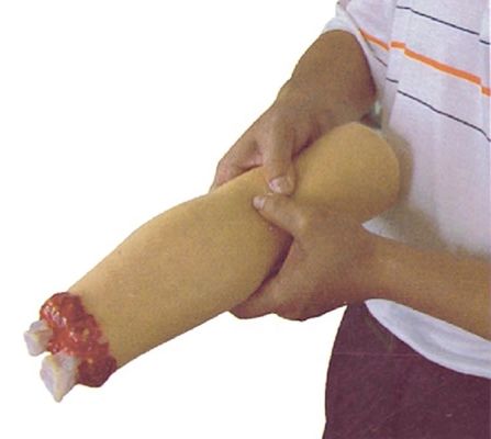 Ιατρική Επιστήμη Τραυματική Φροντίδα προσομοιωτής Αιμορραγία και μοντέλο ακρωτηριασμένου χεριού