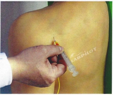 Προχωρημένη ιατρική εκπαίδευση PVC Παράδειγμα διδασκαλίας προσομοιωτή ενδοσωματικής ένεσης αρθρώματος ώμου